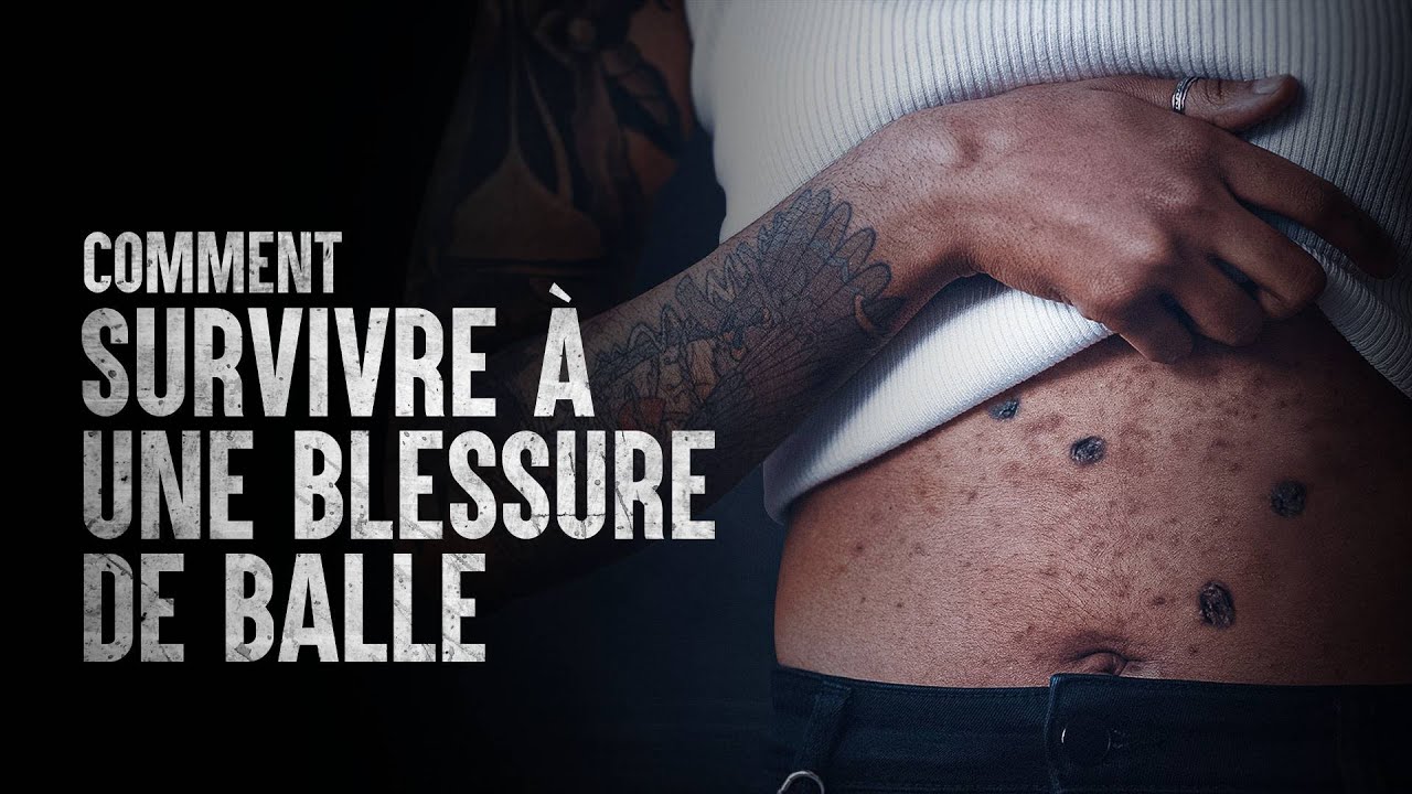 tout savoir sur les poursuites judiciaires liées aux blessures causées par un pistolet à eau : responsabilités, conséquences et conseils légaux.